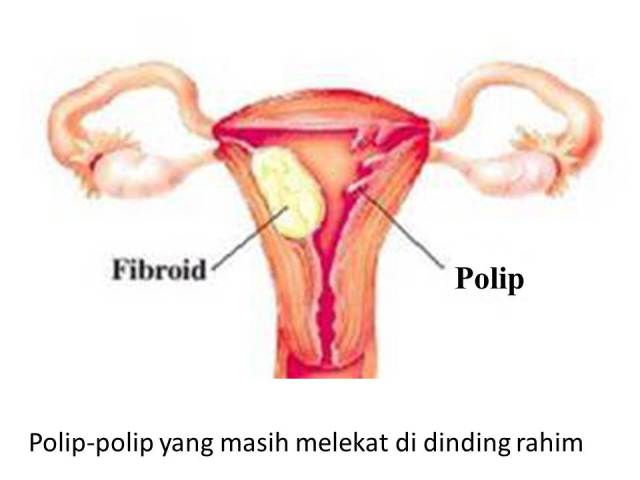 sistem reproduksi wanita